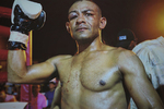 5.-Boxeador-venezolano-muy-golpeado.jpg