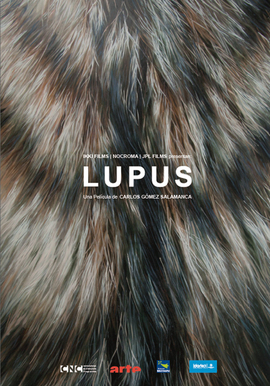 LUPUS